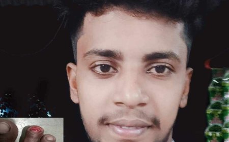 জমি নিয়ে দ্বন্দ্বে পায়ের নক তুলে ফেলে গুরুতর জখম করে