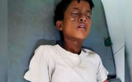 মোবাইল বিস্ফোরণে শিশুর গুরুতর আহত আহত